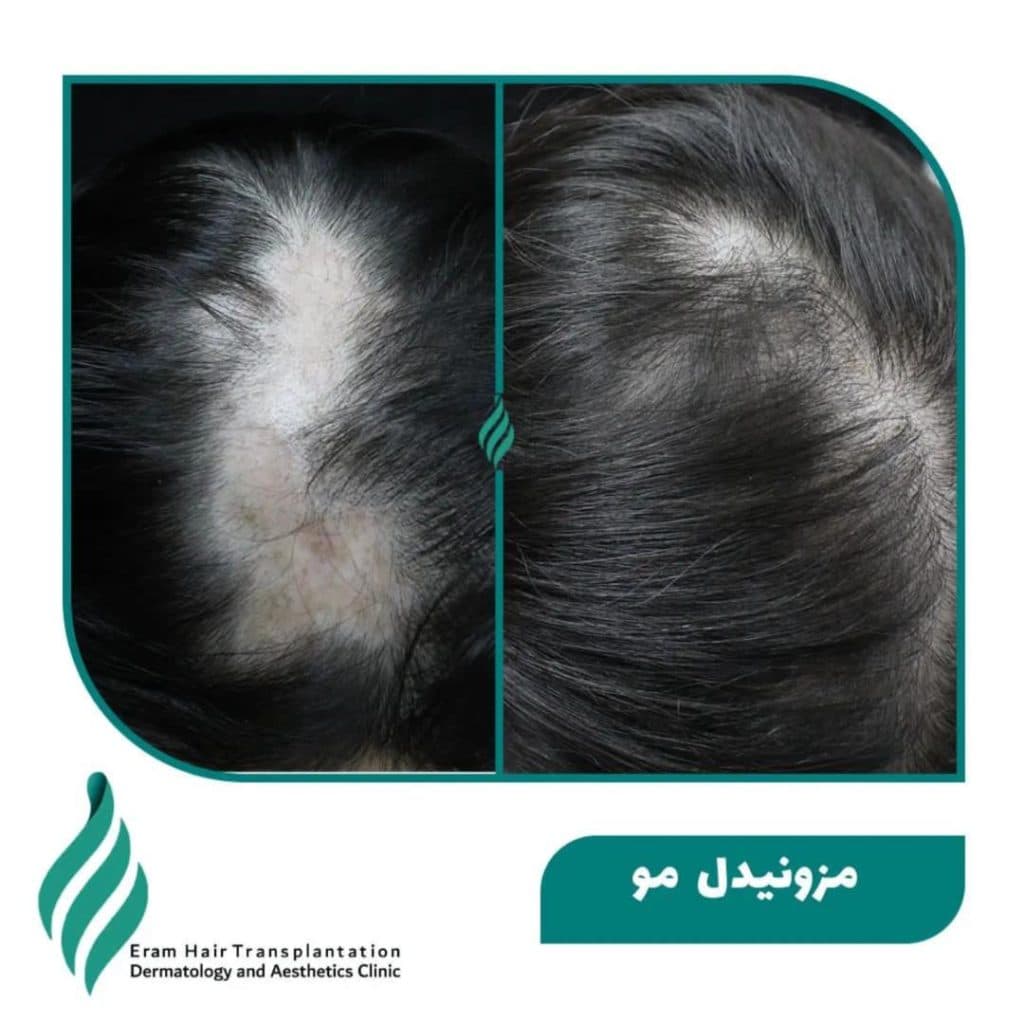 کلینیک تخصصی پوست مو و زیبایی ارم در شیراز