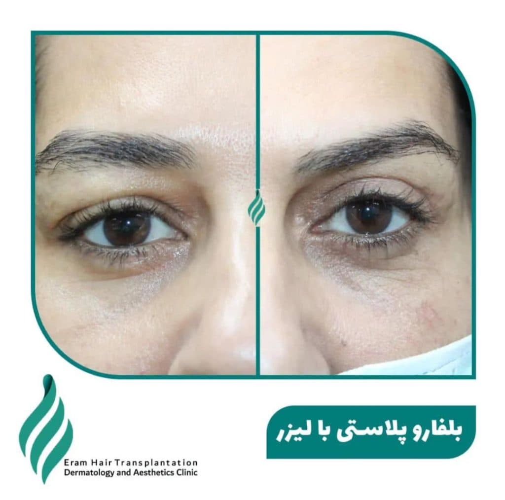 کلینیک تخصصی پوست مو و زیبایی ارم در شیراز