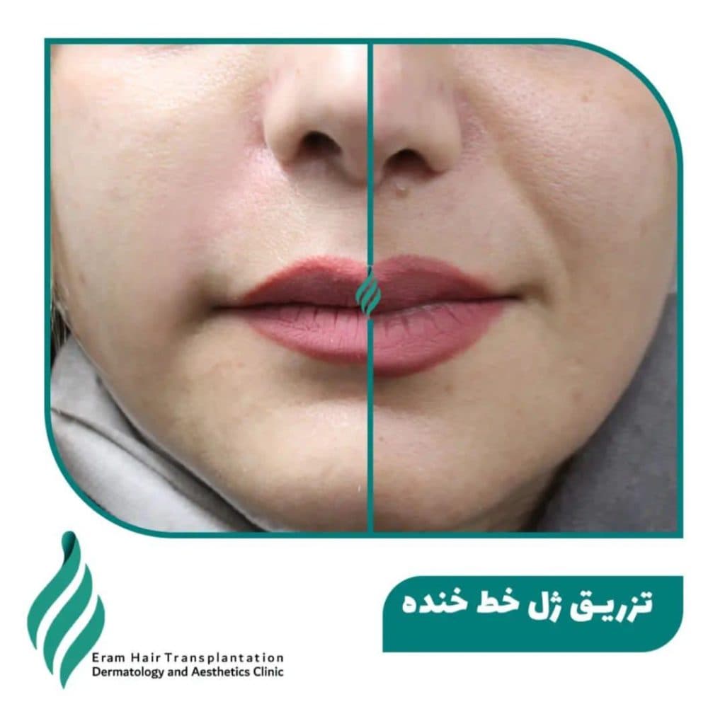 کلینیک تخصصی پوست مو و زیبایی ارم در شیراز