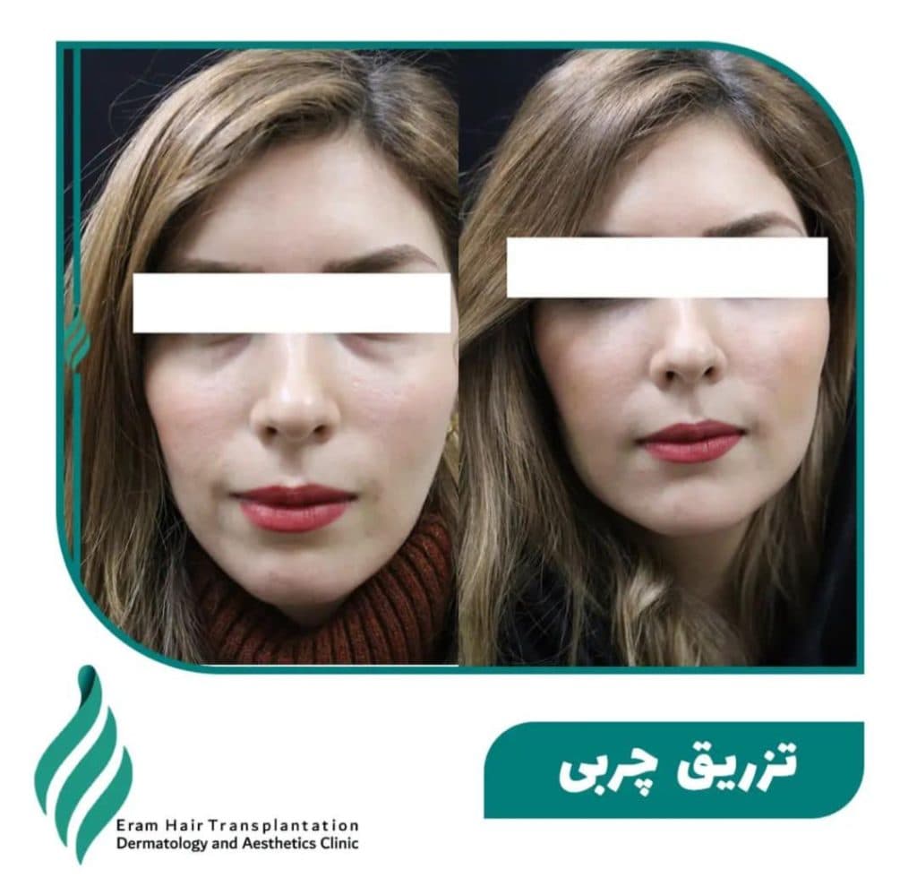 کلینیک تخصصی پوست مو و زیبایی ارم در شیراز