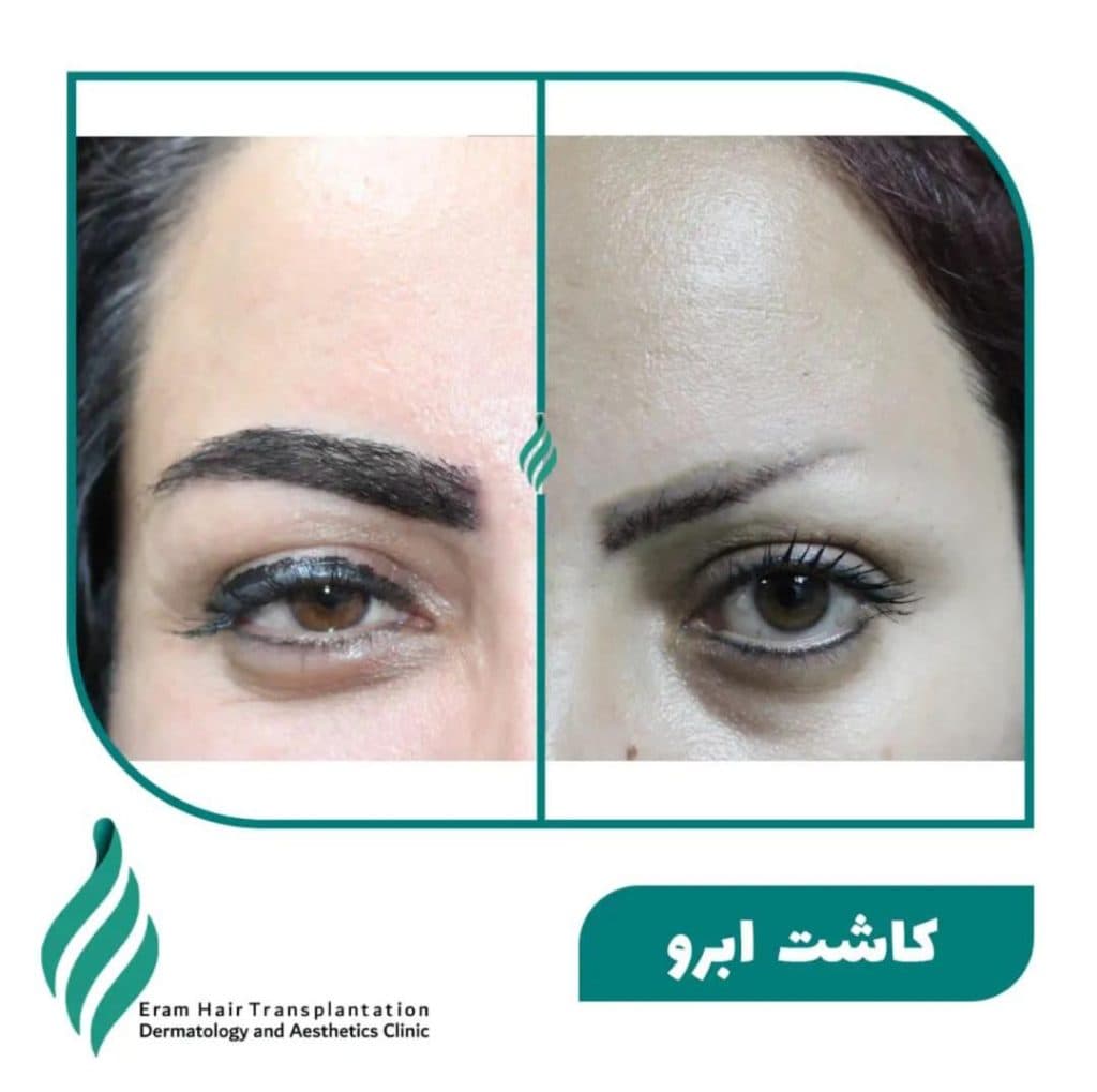 کلینیک تخصصی پوست مو و زیبایی ارم در شیراز