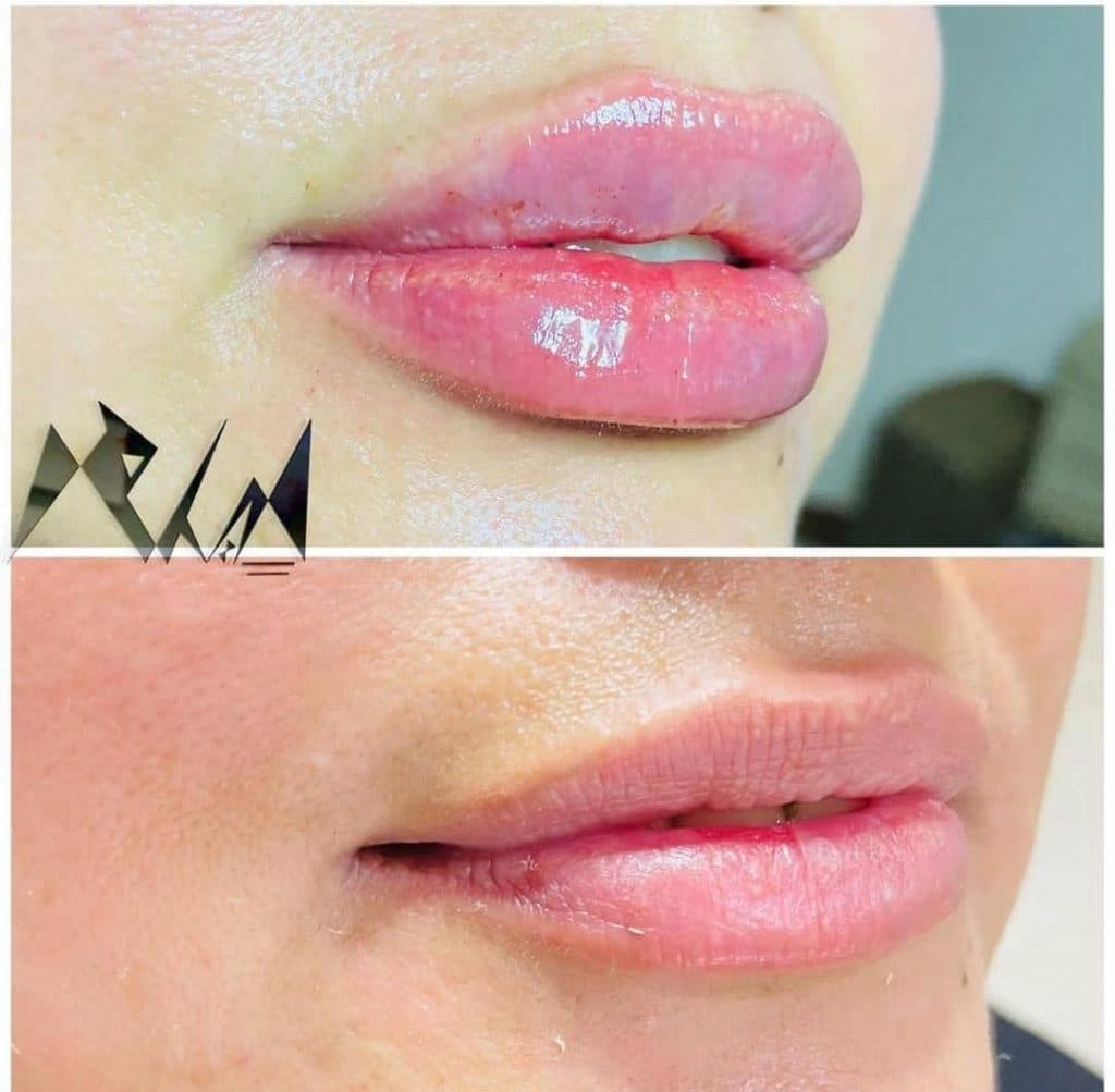 کلینیک زیبایی پوست و مو اعظم در عظیمیه کرج