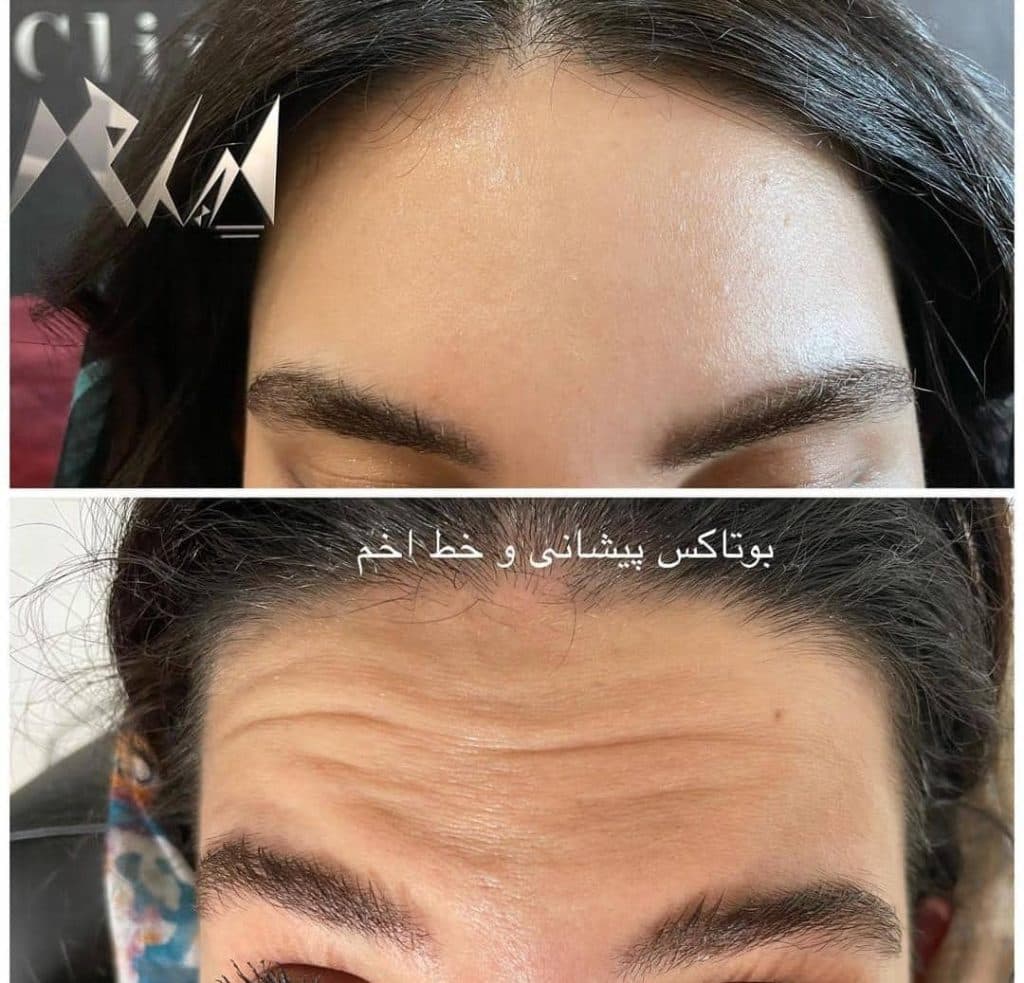 کلینیک زیبایی پوست و مو اعظم در عظیمیه کرج