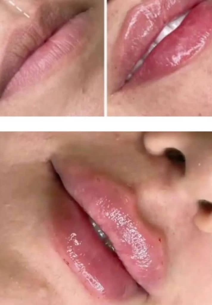 کلینیک زیبایی پوست مو و لیزر هستی محمدی در اصفهان