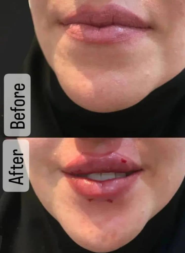 کلینیک زیبایی پوست مو و لیزر هستی محمدی در اصفهان