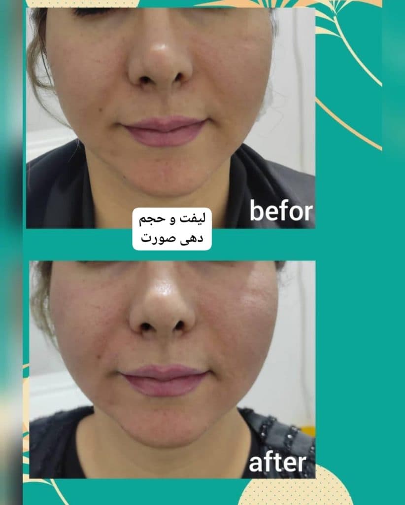 کلینیک تخصصی زیبایی پوست مو و لیزر فوتونا در ایلام