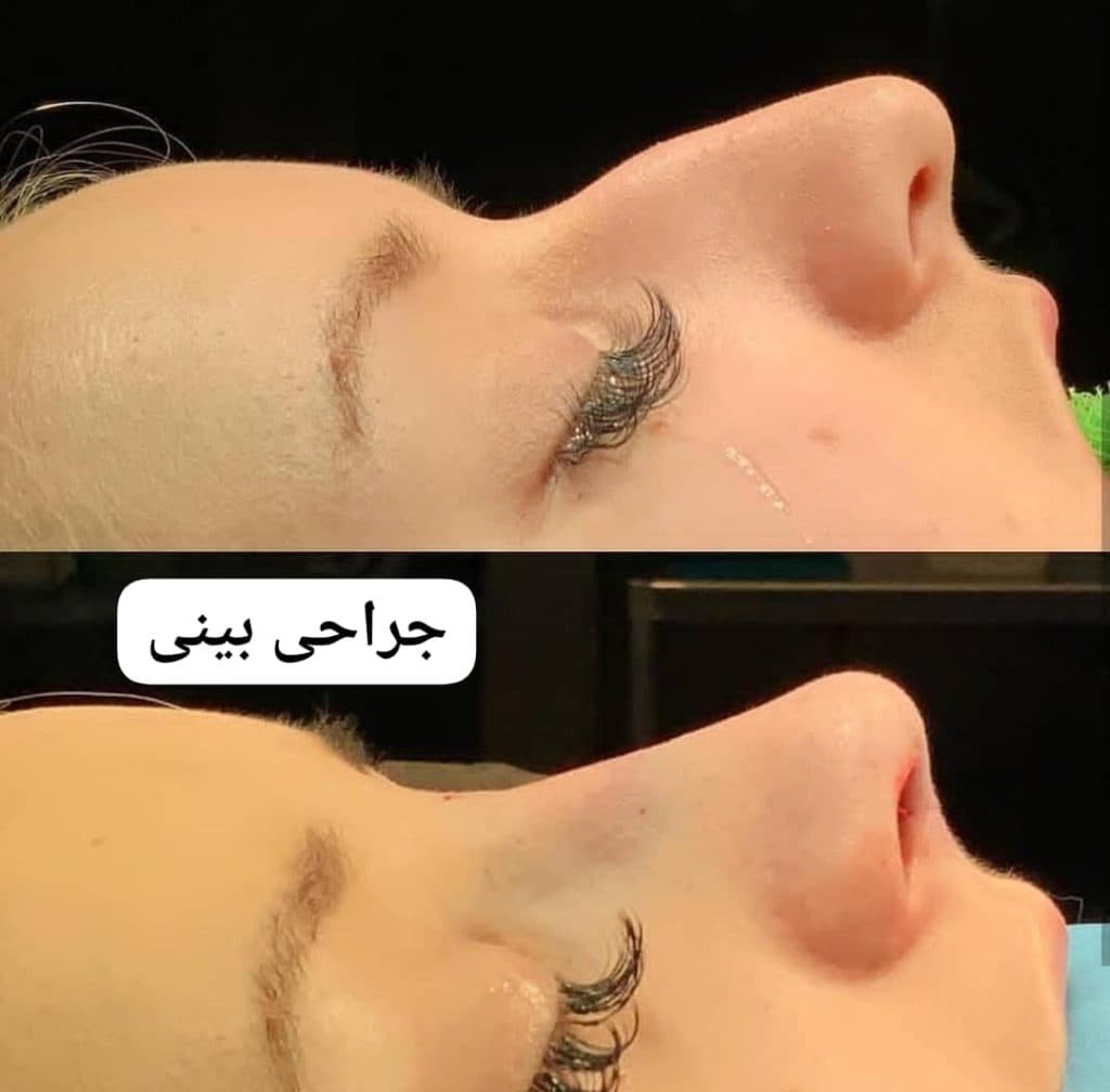 کلینیک تخصصی زیبایی پوست مو و لیزر فوتونا در ایلام