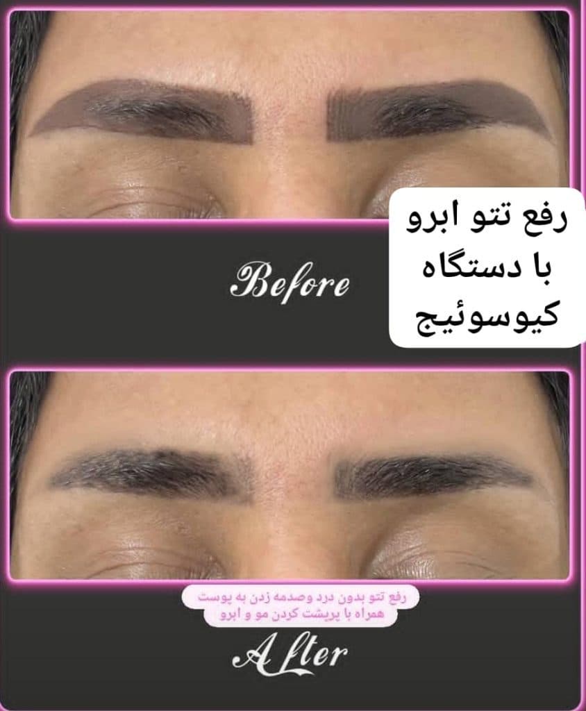 کلینیک تخصصی زیبایی پوست مو و لیزر فوتونا در ایلام