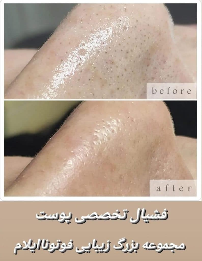 کلینیک تخصصی زیبایی پوست مو و لیزر فوتونا در ایلام