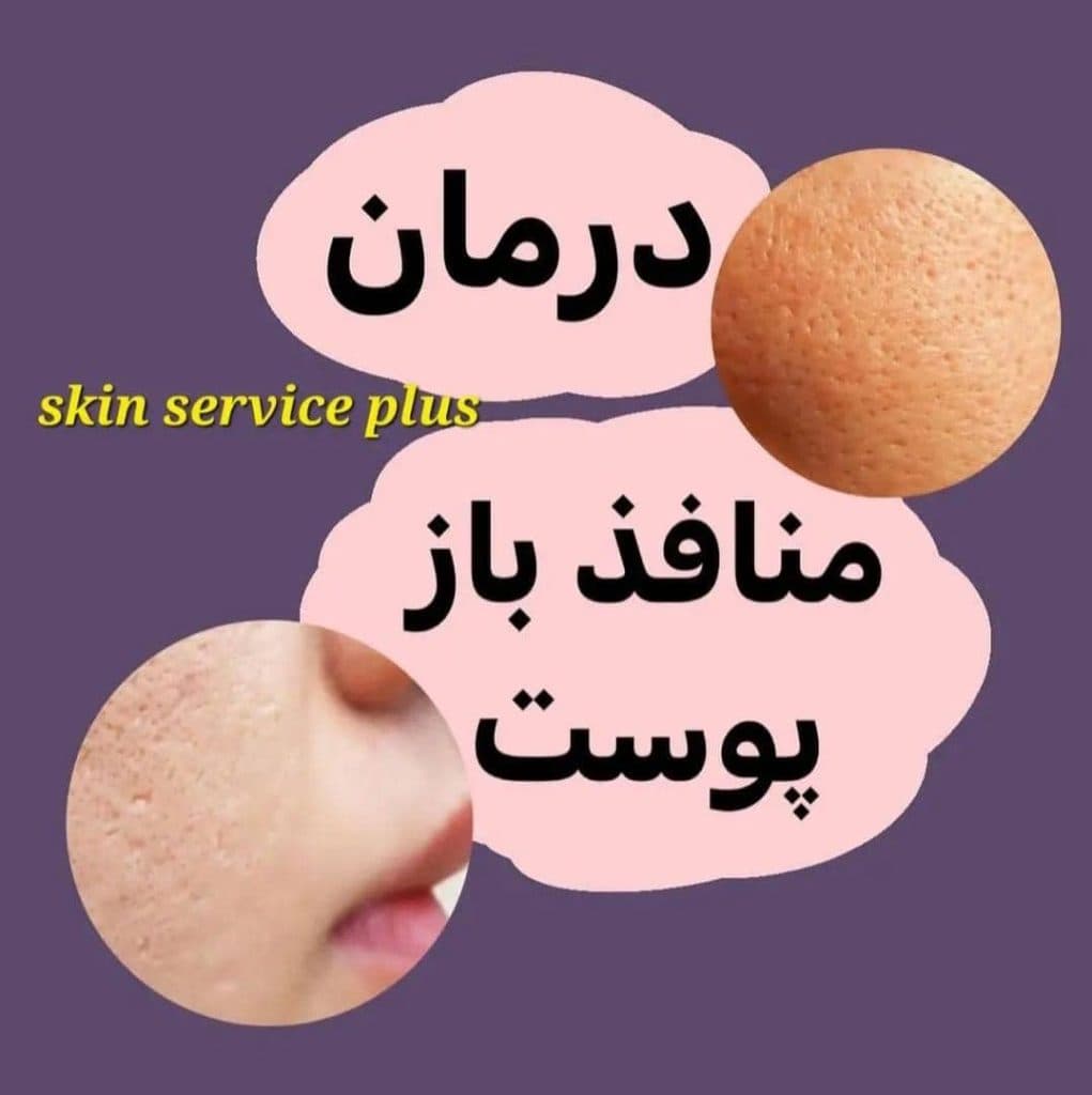 کلینیک زیبایی و درمانی اسکین سرویس پلاس در نوشهر