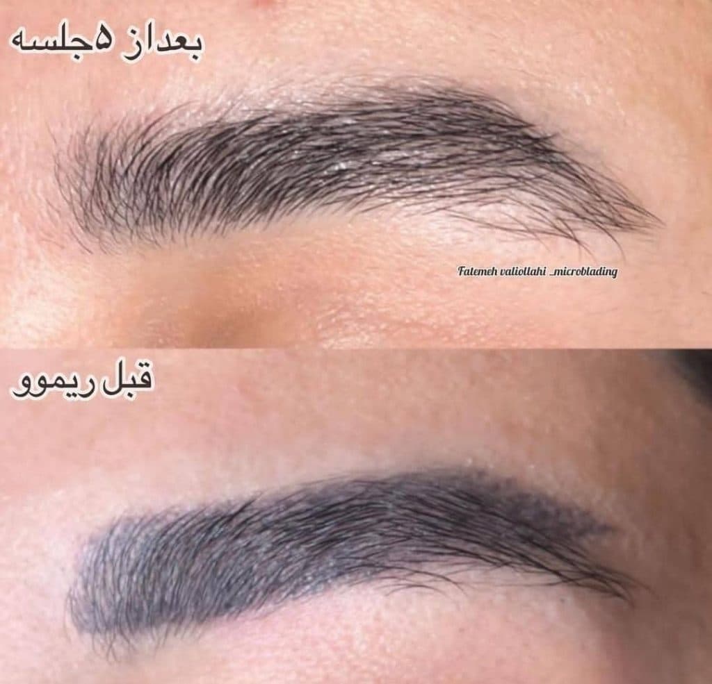 آموزش و خدمات میکروبلیدینگ ابرو و ریموو تتو فاطمه ولی اللهی در تهران