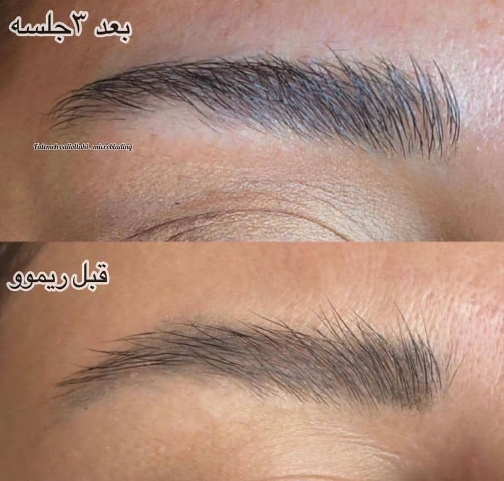 آموزش و خدمات میکروبلیدینگ ابرو و ریموو تتو فاطمه ولی اللهی در تهران