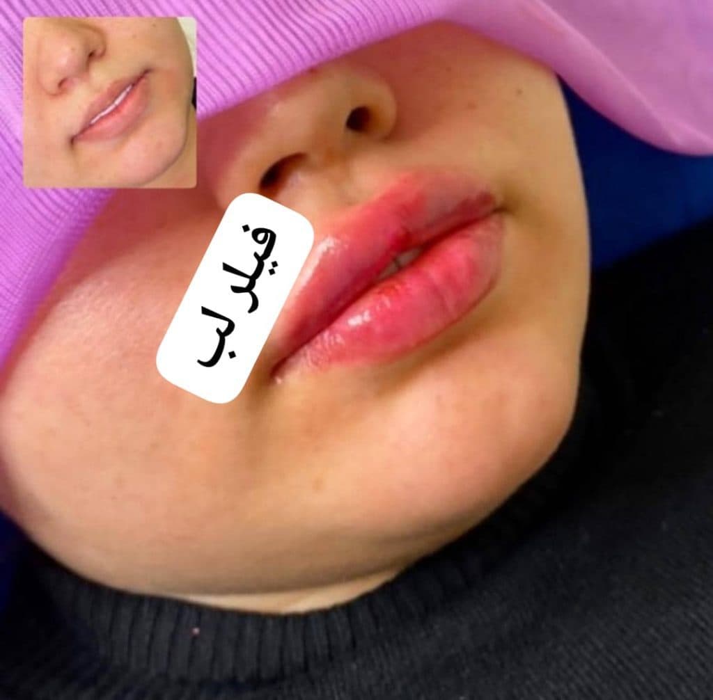 کلینیک زیبایی پوست و مو احمدیان در سمنان