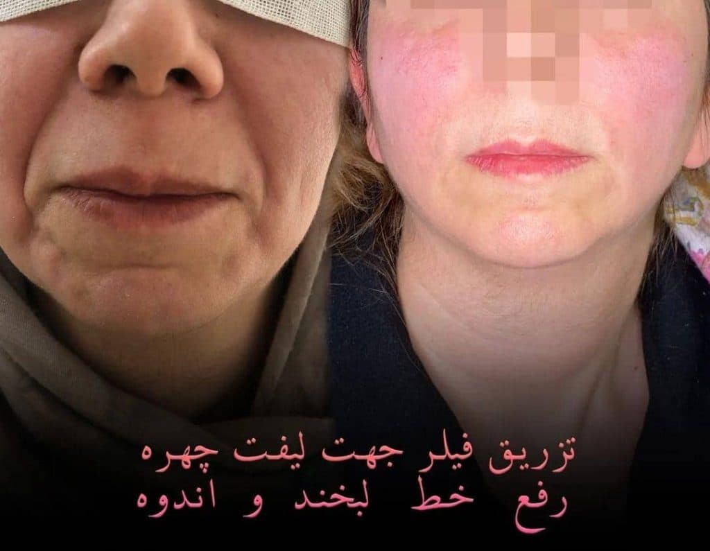 کلینیک زیبایی پوست و مو احمدیان در سمنان