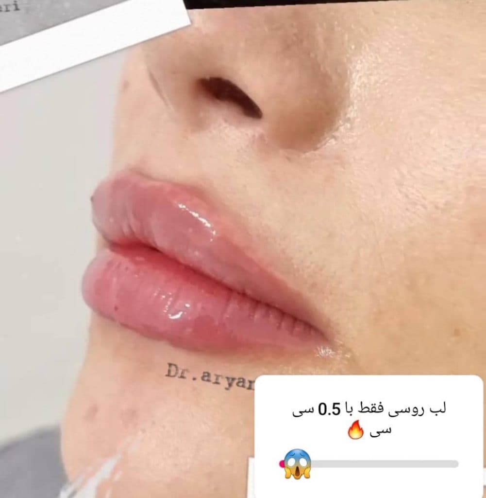 مرکز و کلینیک زیبایی لیزر ژل بوتاکس دکتر آرین صفری در نکا