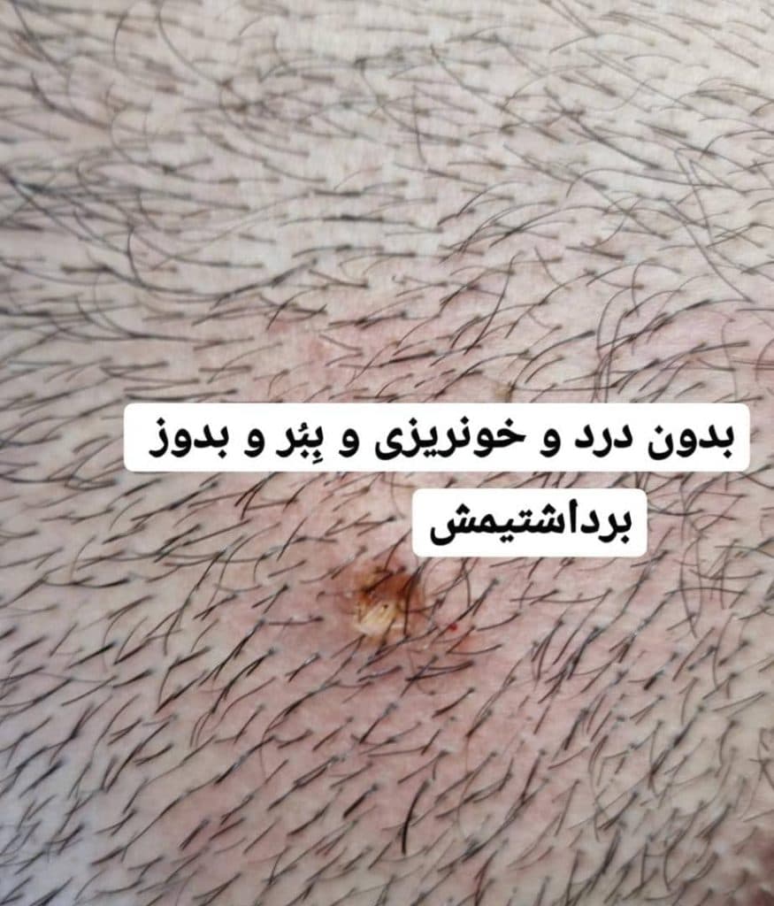 مرکز و کلینیک زیبایی لیزر ژل بوتاکس دکتر آرین صفری در نکا