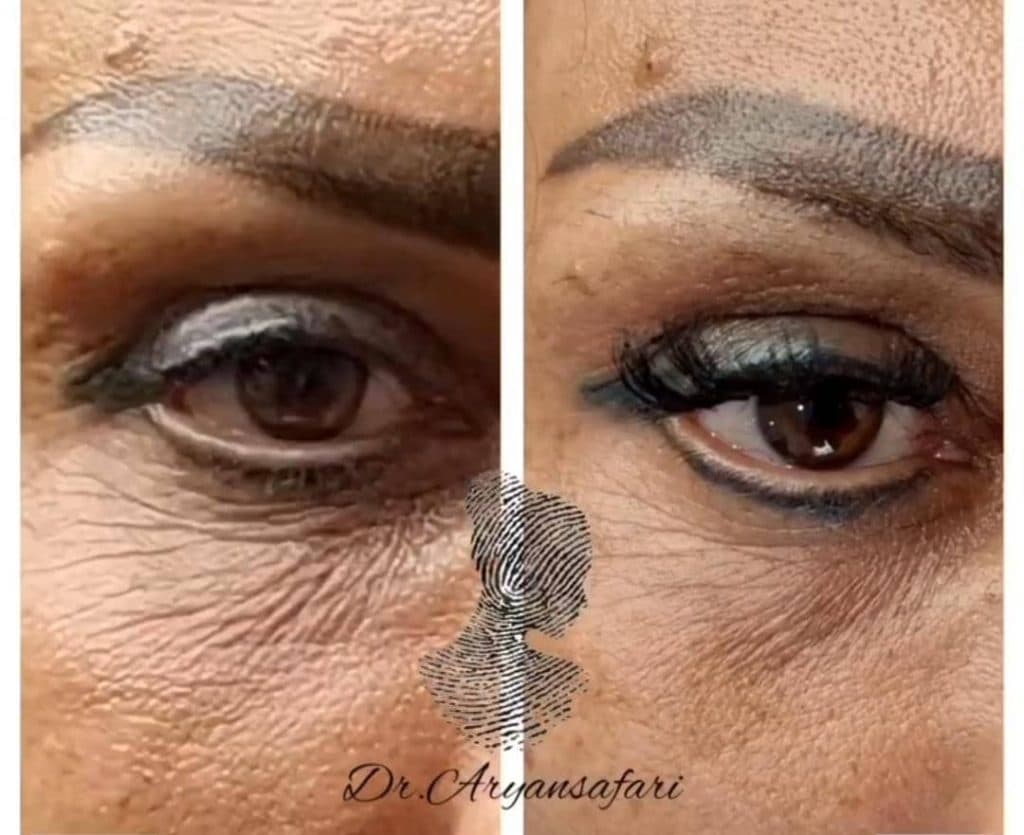 مرکز و کلینیک زیبایی لیزر ژل بوتاکس دکتر آرین صفری در نکا