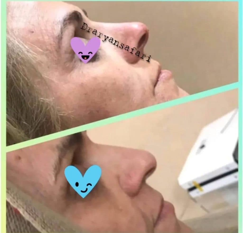 مرکز و کلینیک زیبایی لیزر ژل بوتاکس دکتر آرین صفری در نکا