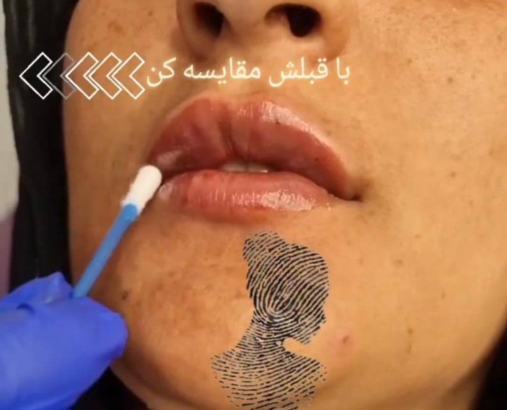 مرکز و کلینیک زیبایی لیزر ژل بوتاکس دکتر آرین صفری در نکا