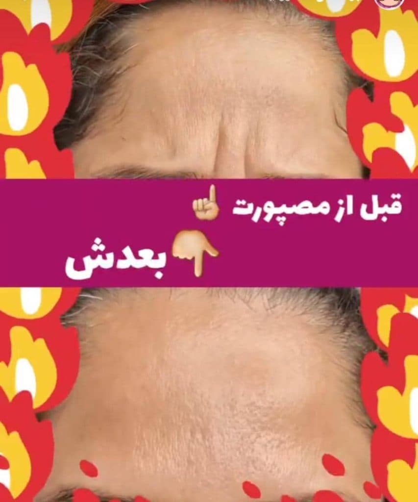 مرکز و کلینیک زیبایی لیزر ژل بوتاکس دکتر آرین صفری در نکا