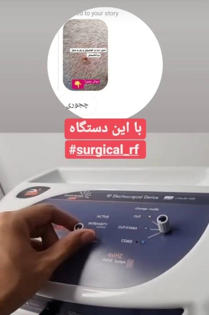 مرکز و کلینیک زیبایی لیزر ژل بوتاکس دکتر آرین صفری در نکا