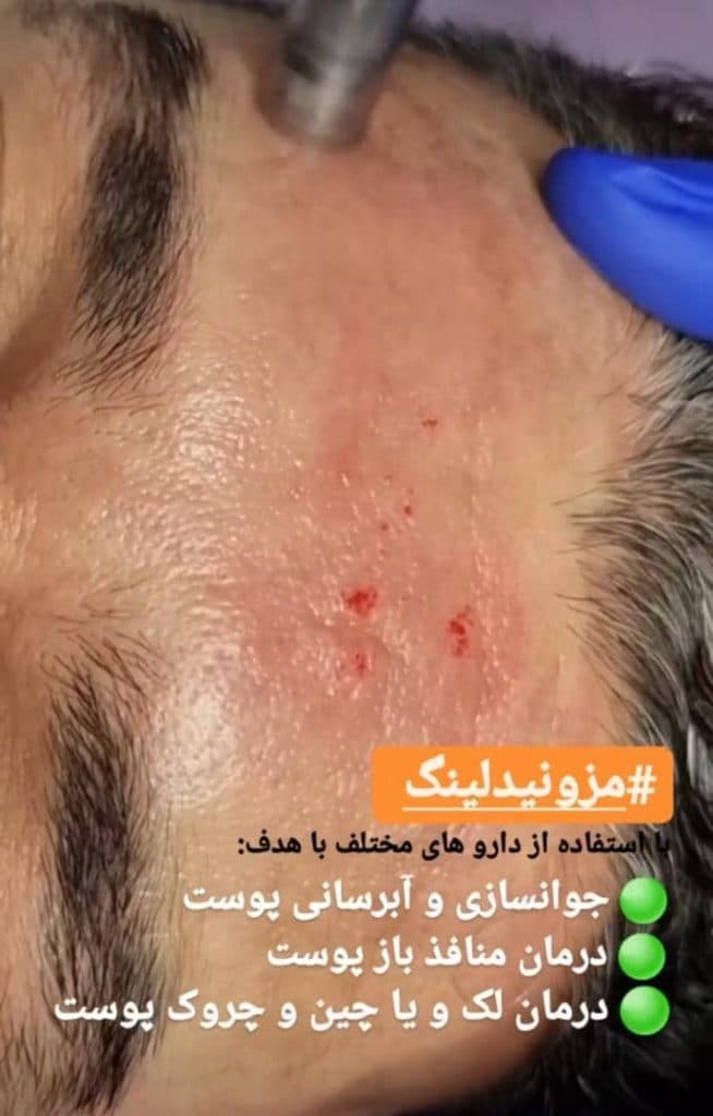 مرکز و کلینیک زیبایی لیزر ژل بوتاکس دکتر آرین صفری در نکا