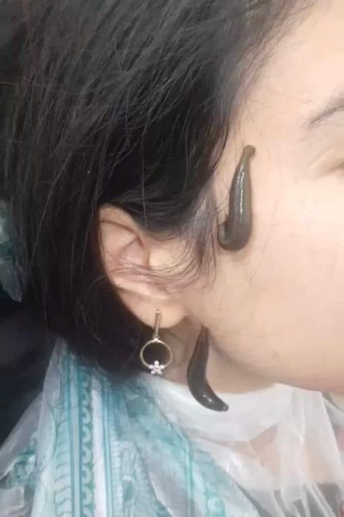 مهسا حلاجی حکیم طب سنتی و حجامت بادکش گرم در یزد