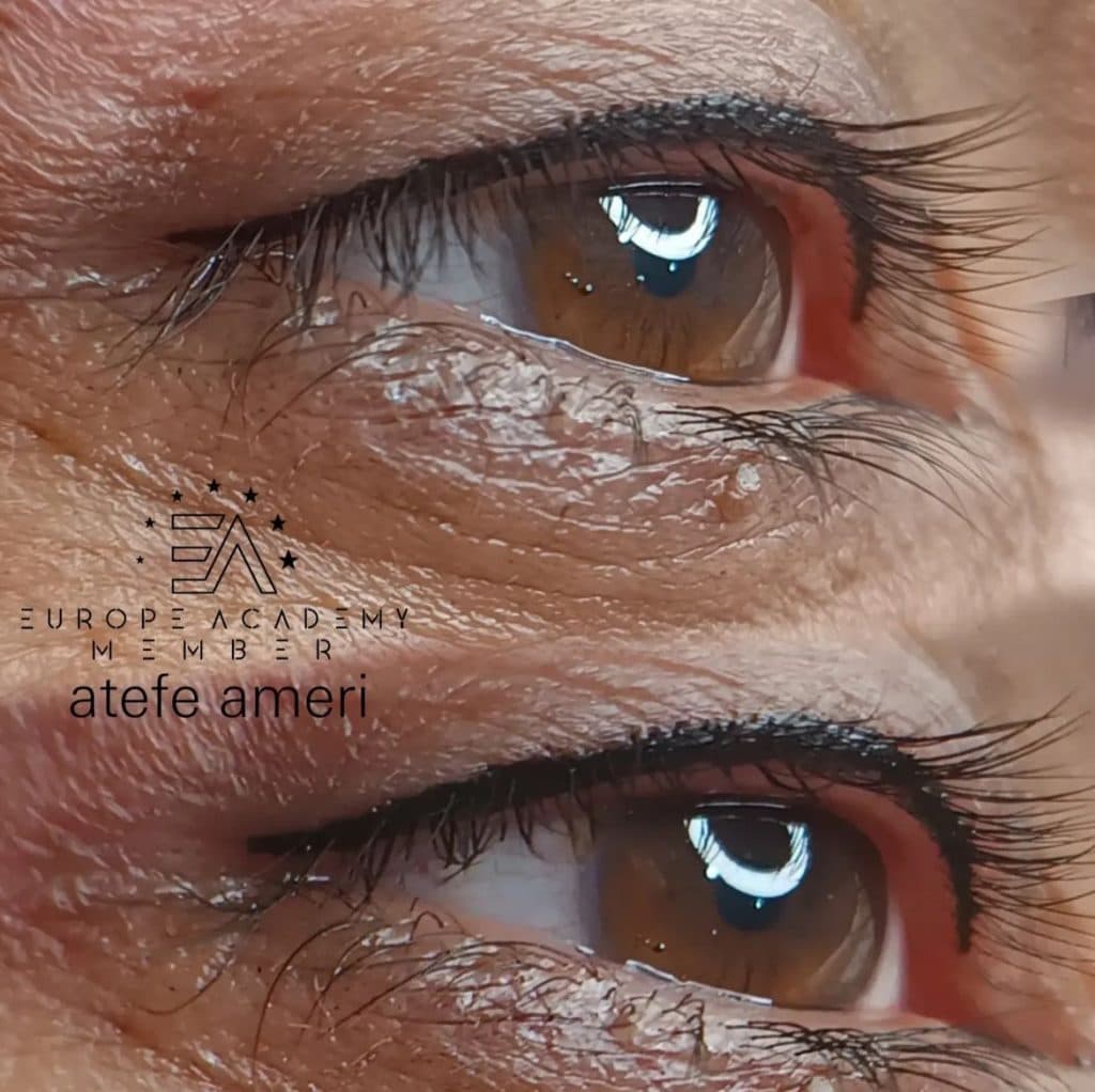 مرکز تخصصی میکروبلیدینگ ابرو و ریموو تتو عاطفه عامری در مشهد