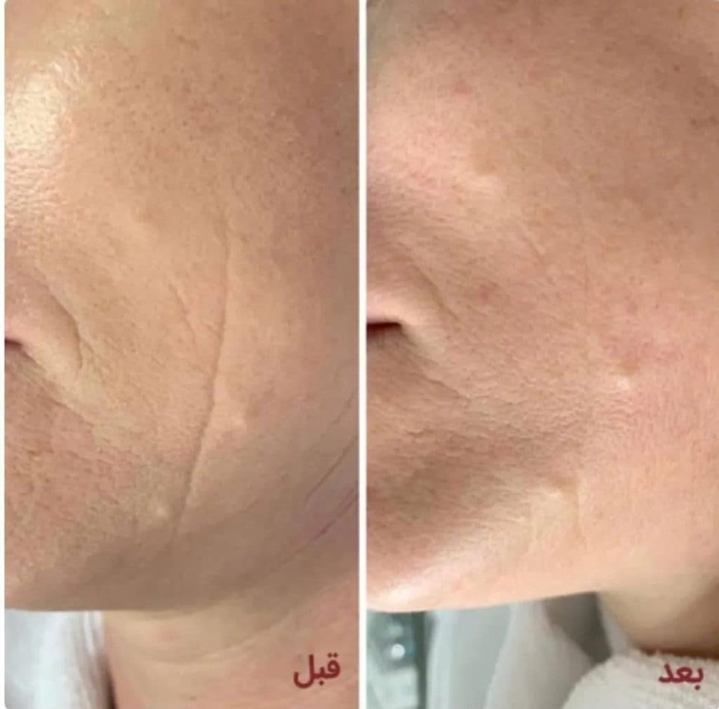 کلینیک زیبایی لیزر هایفوژل و بوتاکس برلیان در معالی آباد شیراز