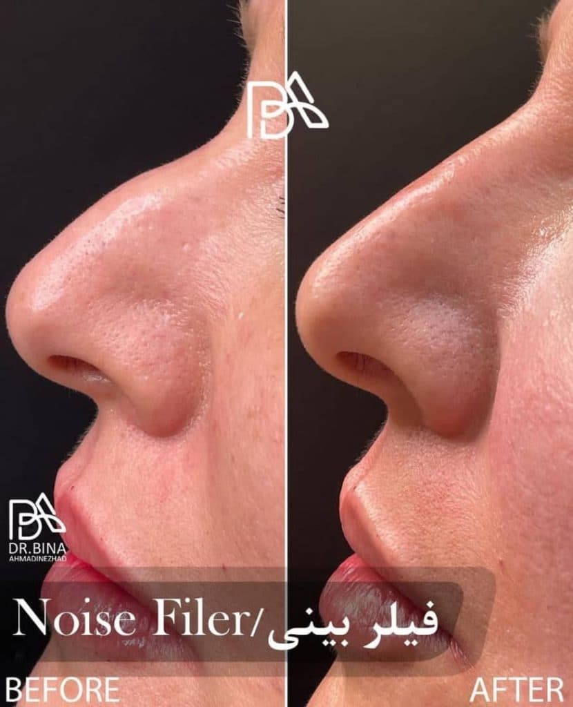 مطب زیبایی پوست و مو دکتر بینا احمدی نژاد در تهران