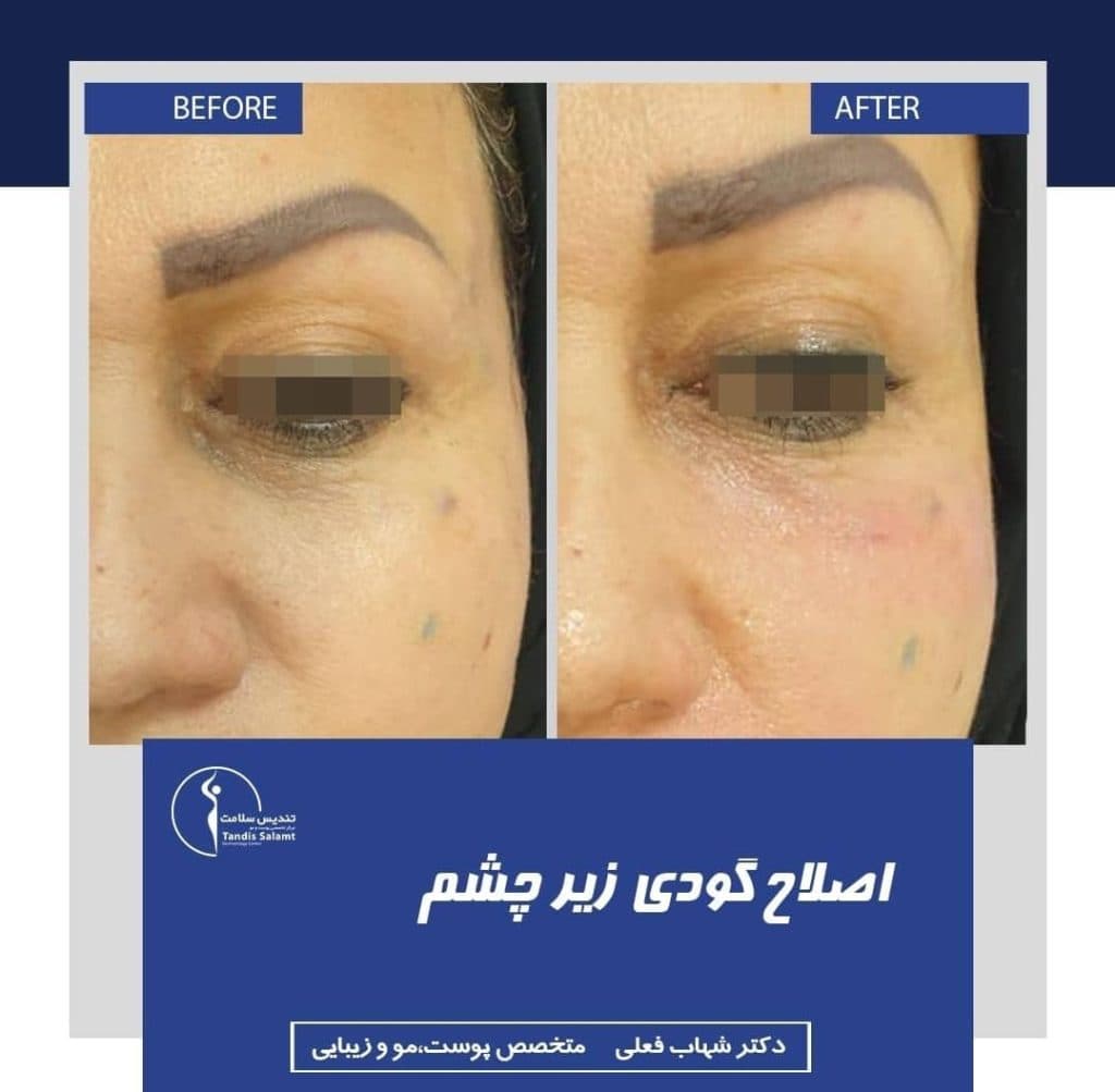 کلینیک تخصصی زیبایی پوست و مو تندیس سلامت در مشهد