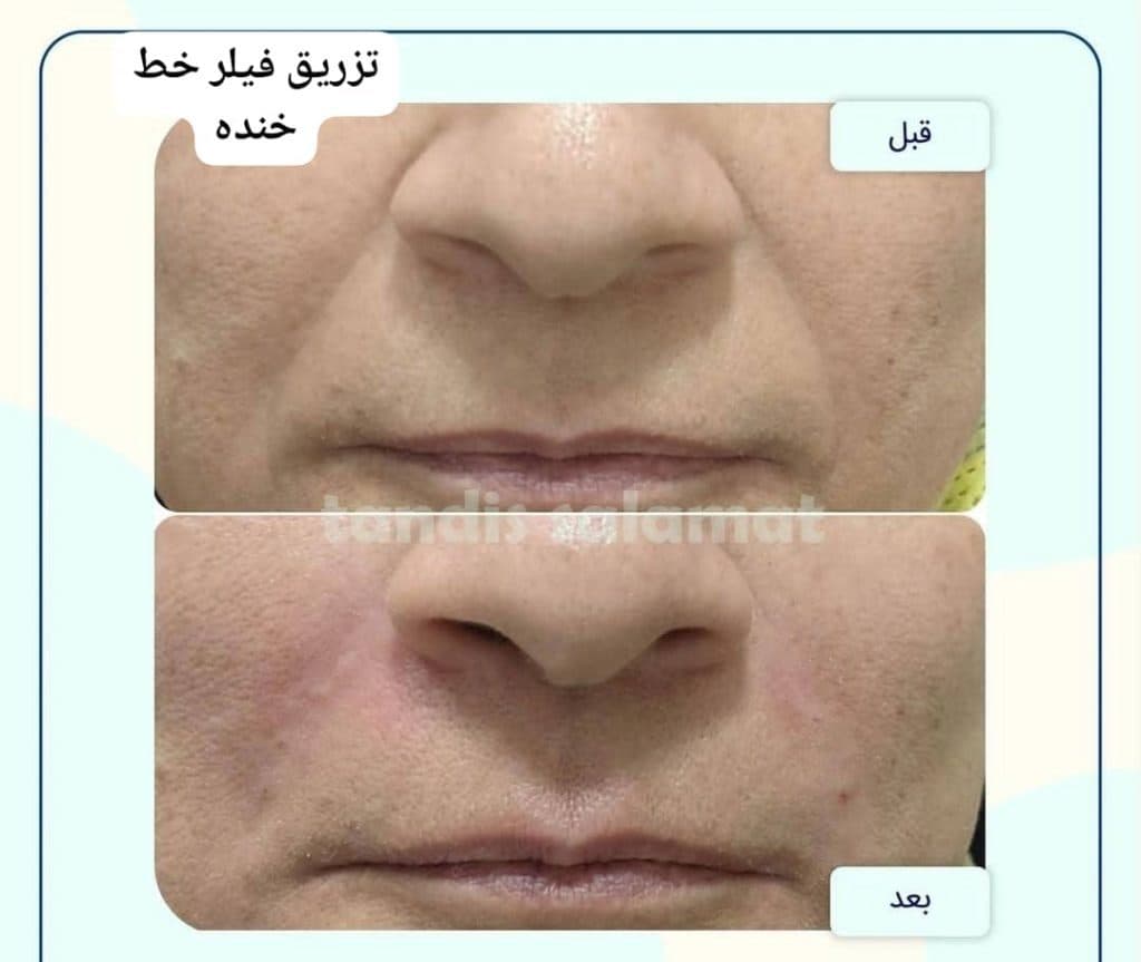 کلینیک تخصصی زیبایی پوست و مو تندیس سلامت در مشهد