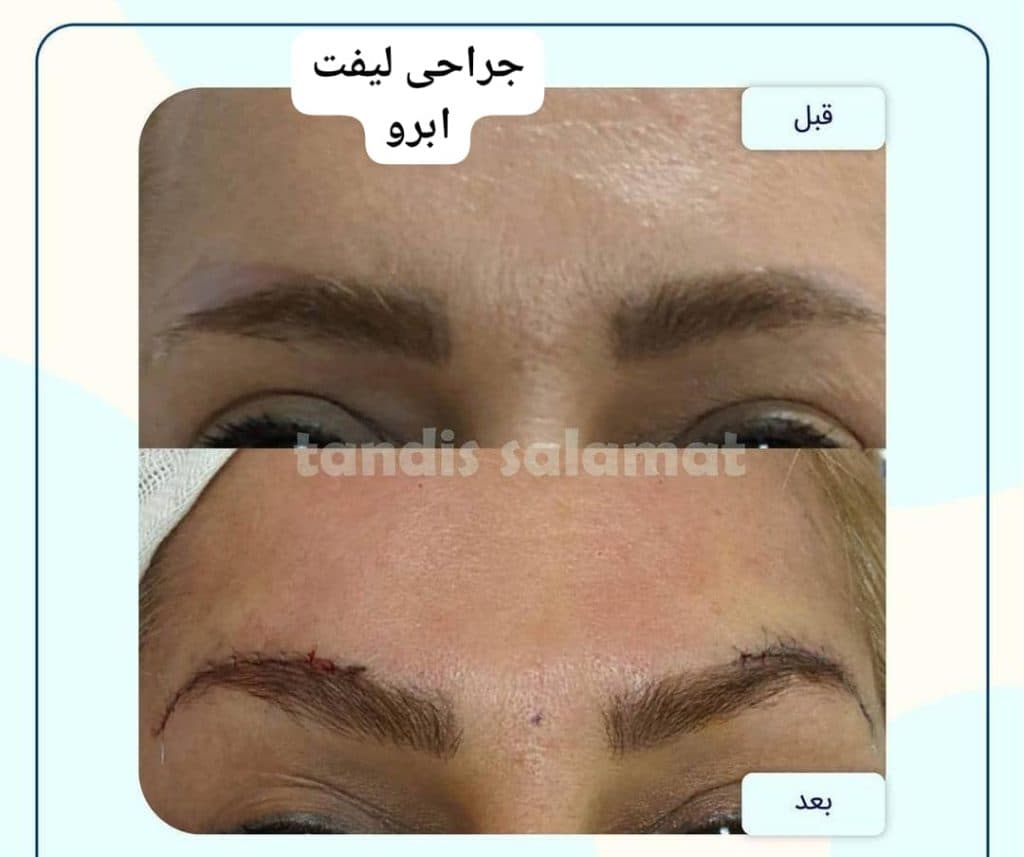 کلینیک تخصصی زیبایی پوست و مو تندیس سلامت در مشهد