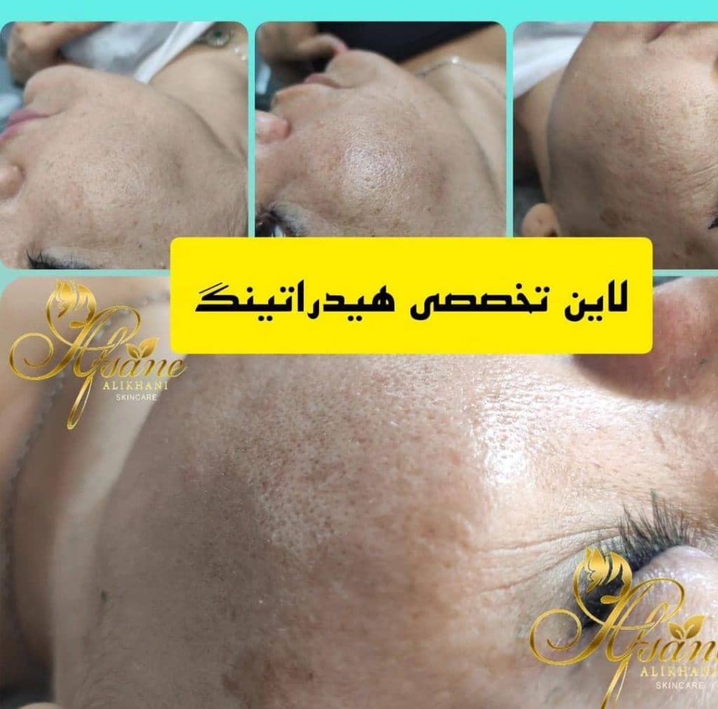 مرکز تخصصی مراقبت پوست و مو گرانسا افسانه علیخانی در شاهرود