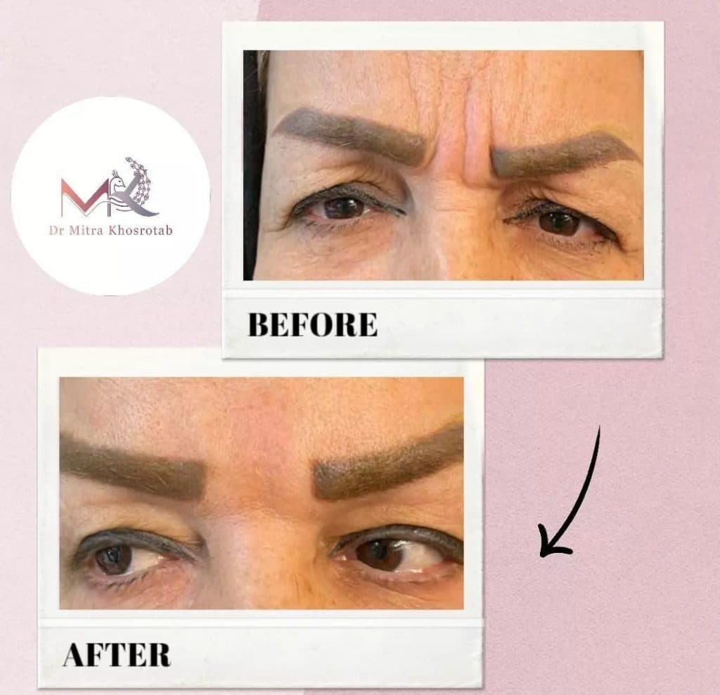 مطب زیبایی پوست و مو دکتر میترا خسرو طبع در تبریز