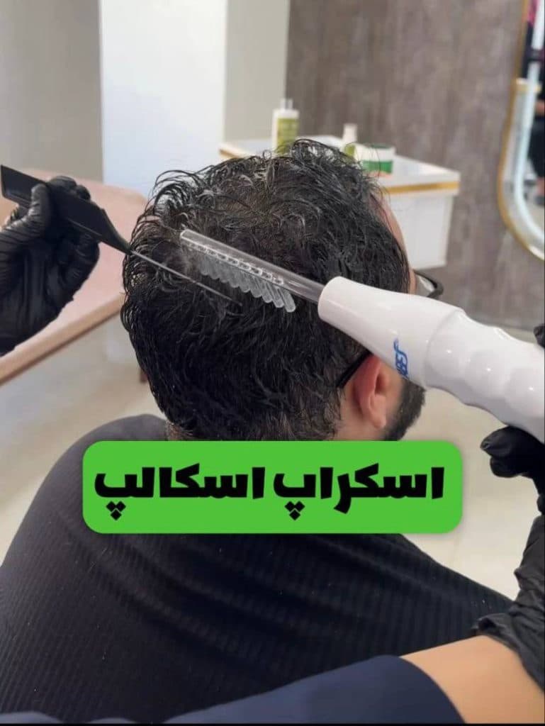 مرکز تخصصی میکرواسکالپ و درمان کم پشتی مو نازنین لحیم چی در بابل مازندران