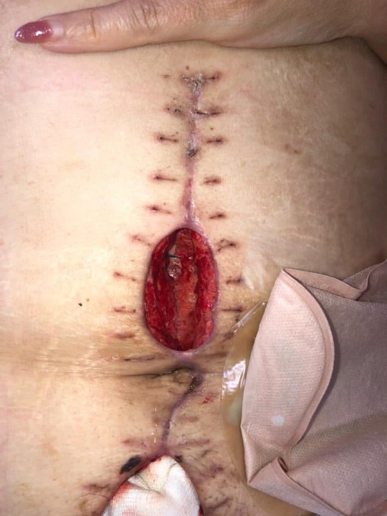 مرکز ارائه مراقبت های پرستاری در منزل سلامت پای تارا در لاهیجان گیلان