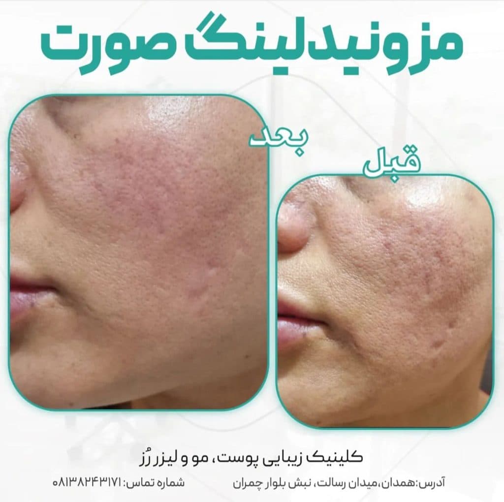 پزشک پوست و مو دکتر فاطمه قاسمی در همدان