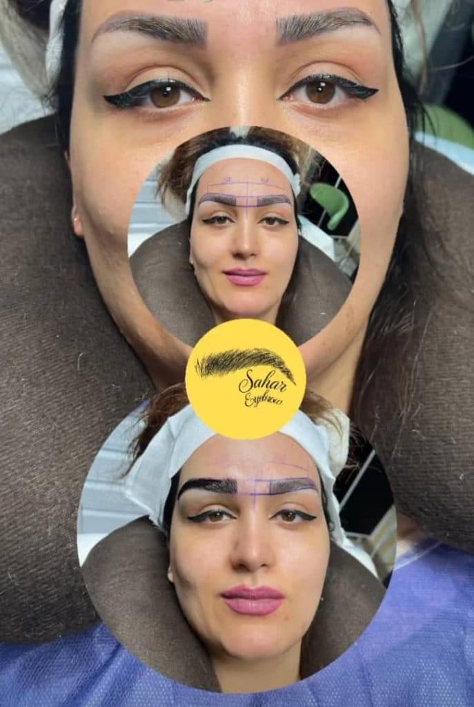 کلینیک تخصصی کاشت دائمی ابرو سحر اسدی در تهران