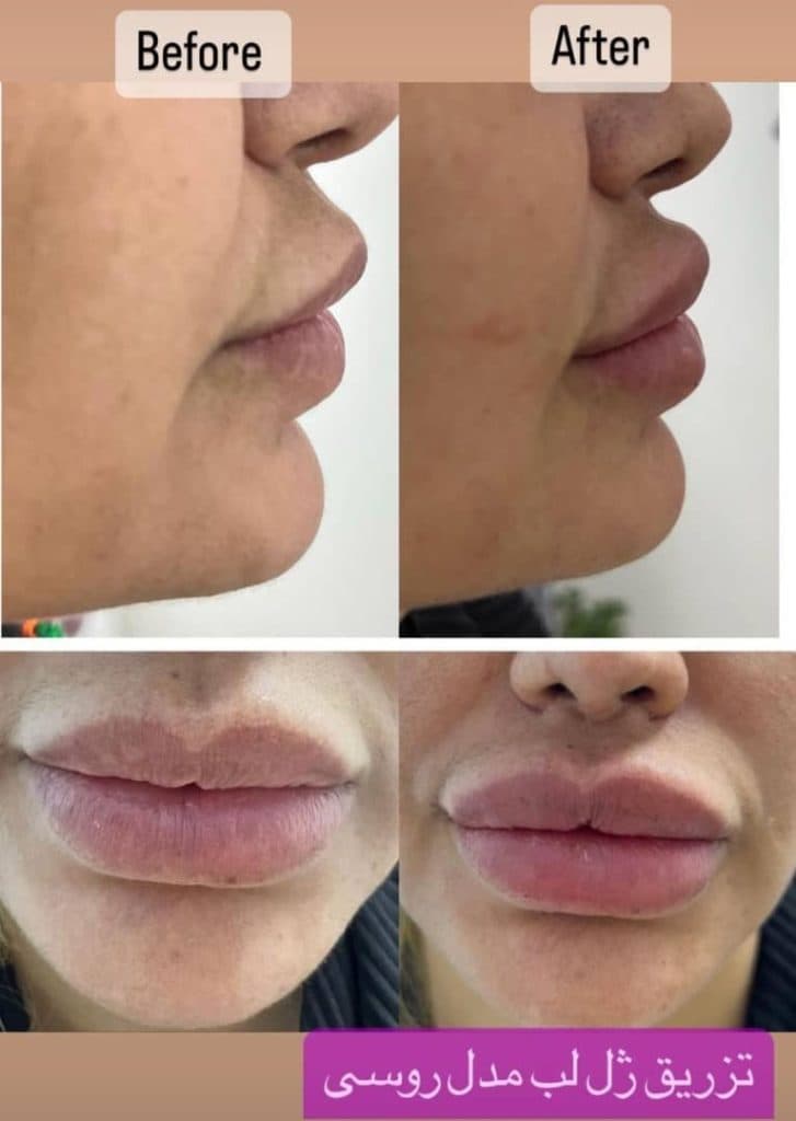 کلینیک تخصصی زیبایی پوست مو و لیزر پرنیا در جنت آباد مرکزی تهران