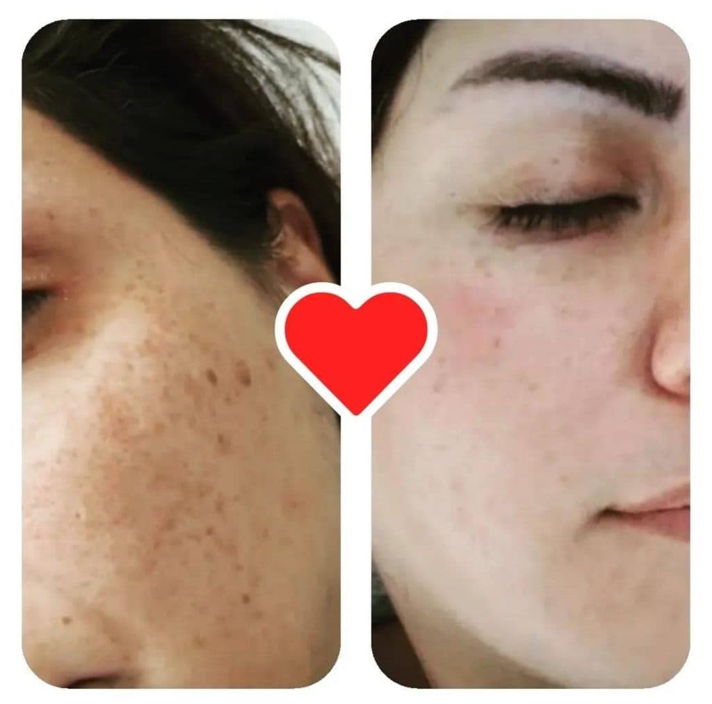 مرکز تخصصی و آموزشی فشیال و پاکسازی پوست شانا بیوتی در شیراز