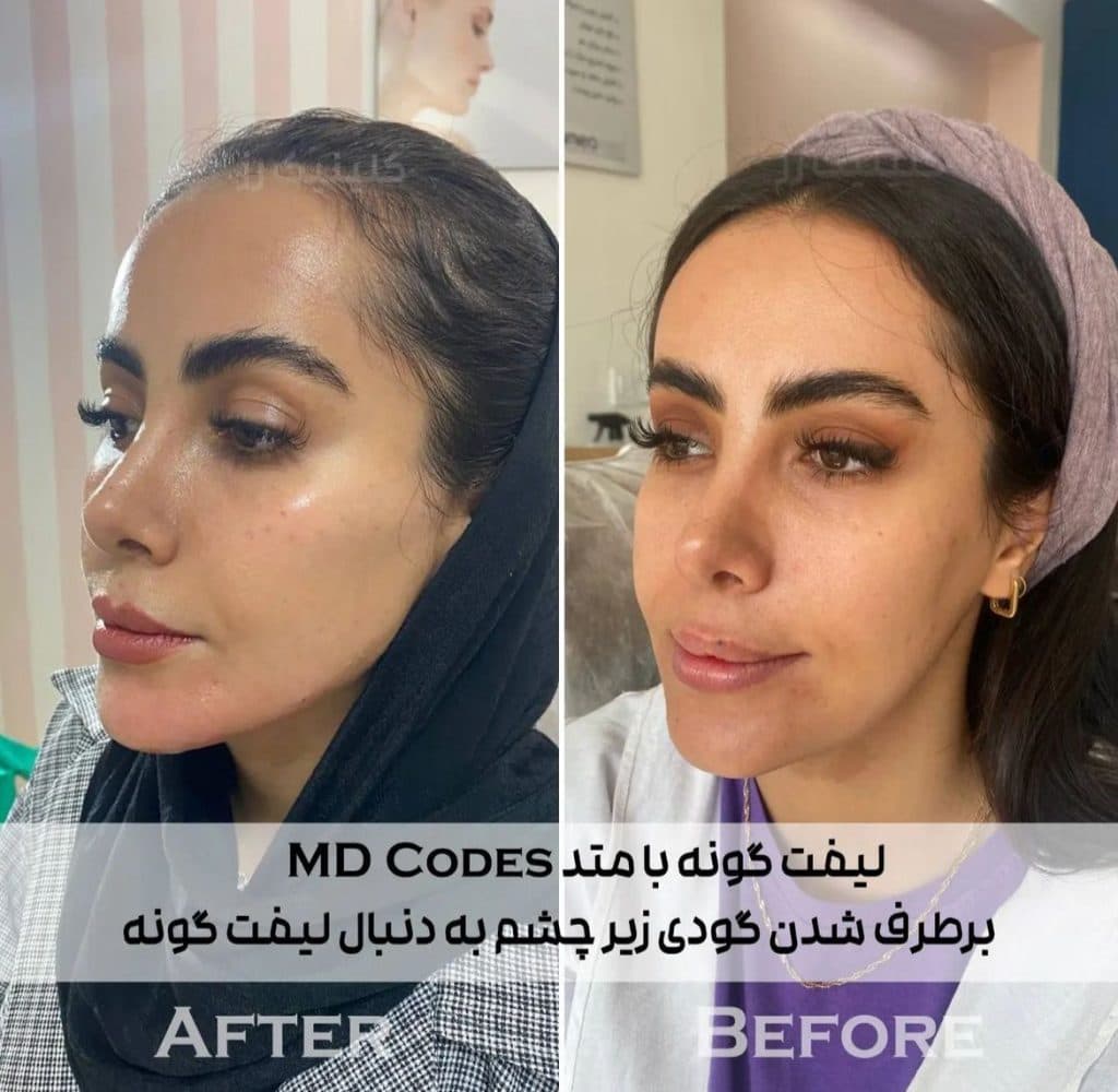 پزشک پوست و مو دکتر فاطمه قاسمی در همدان