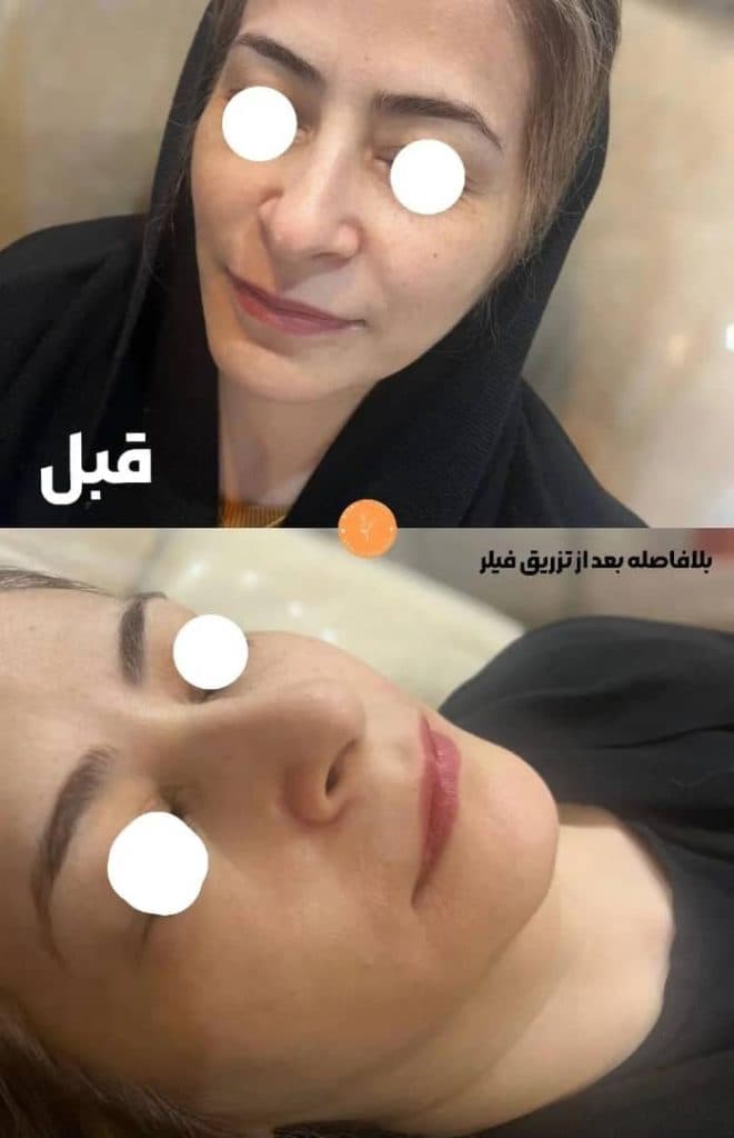 کلینیک درمانی زیبایی پوست و مو ماری در تهران