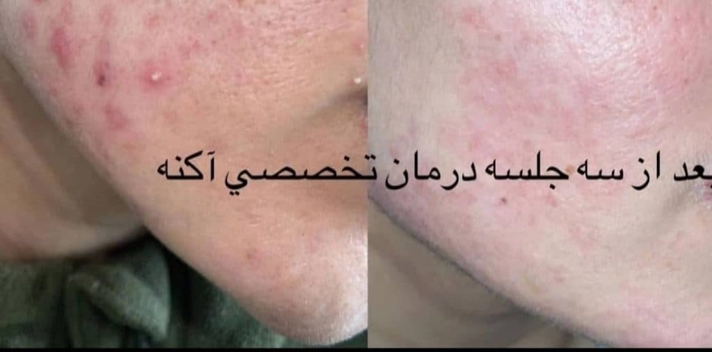 کلینیک مراقبتی پوست و مو آذین در کرمان