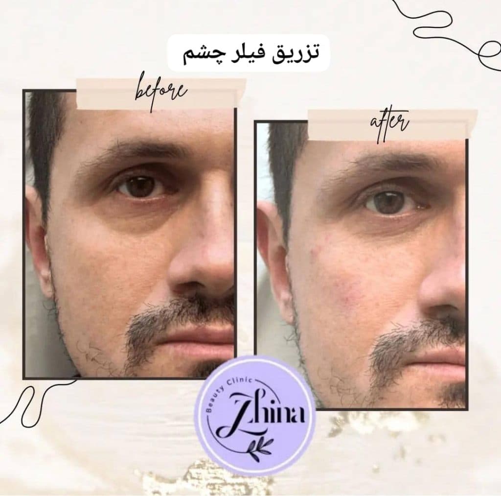 کلینیک درمانی زیبایی پوست و مو ماری در تهران