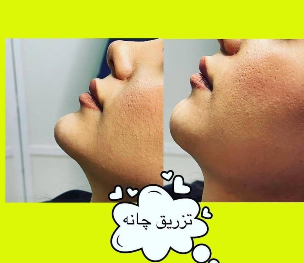 کلینیک زیبایی پوست و مو نیکو رویان نوژان در مشهد