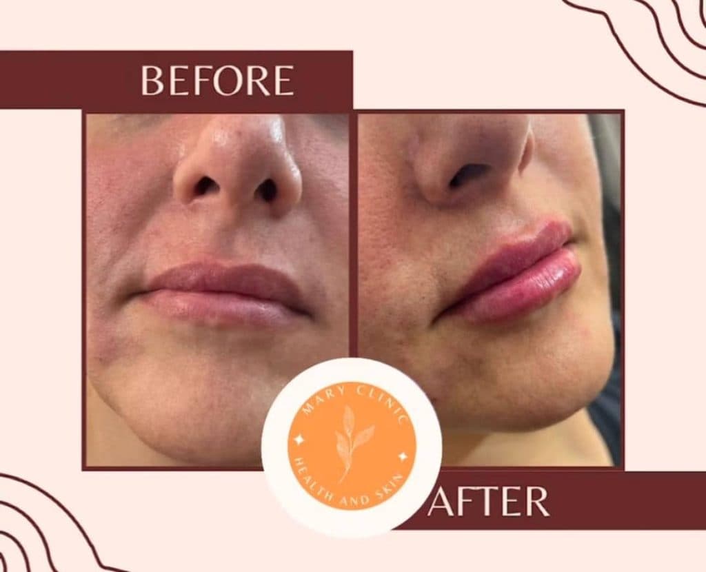 کلینیک درمانی زیبایی پوست و مو ماری در تهران