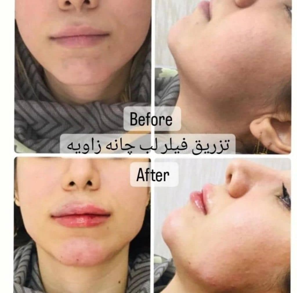 کلینیک زیبایی و لیزر الیزه شرق در تهران