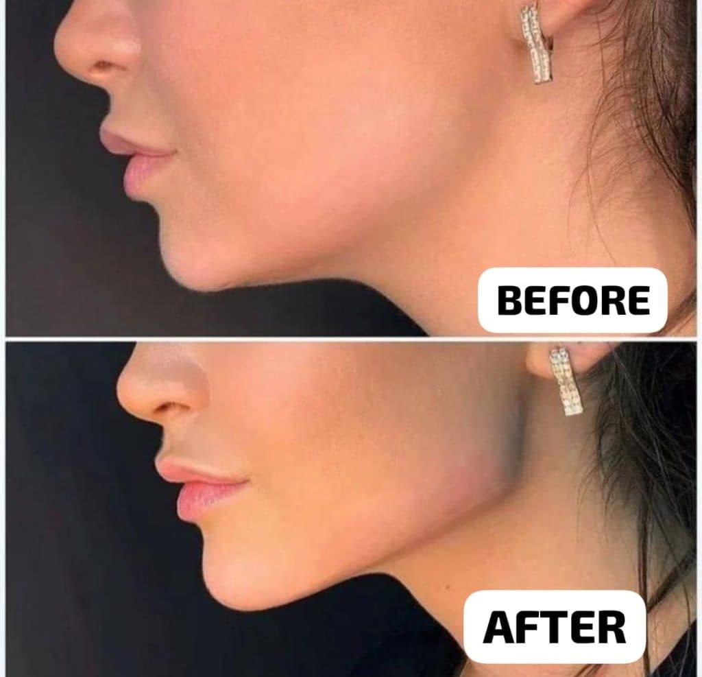 کلینیک زیبایی و لیزر الیزه شرق در تهران