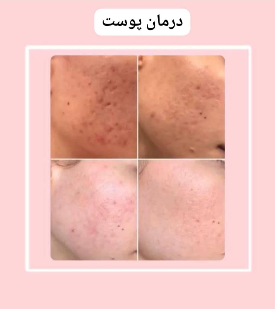 کلینیک زیبایی و لیزر الیزه شرق در تهران